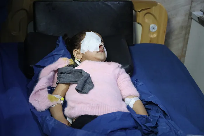 Suriye'de SDG adını kullanan terör örgütü PKK/YPG'nin Halep'te Suriye ordusuna saldır düzenledi. Saldırı sonucu aralarında çocukların da bulunduğu yaralılar, Halep'teki bir hastaneye kaldırılarak tedavi altına alındı. (AA)