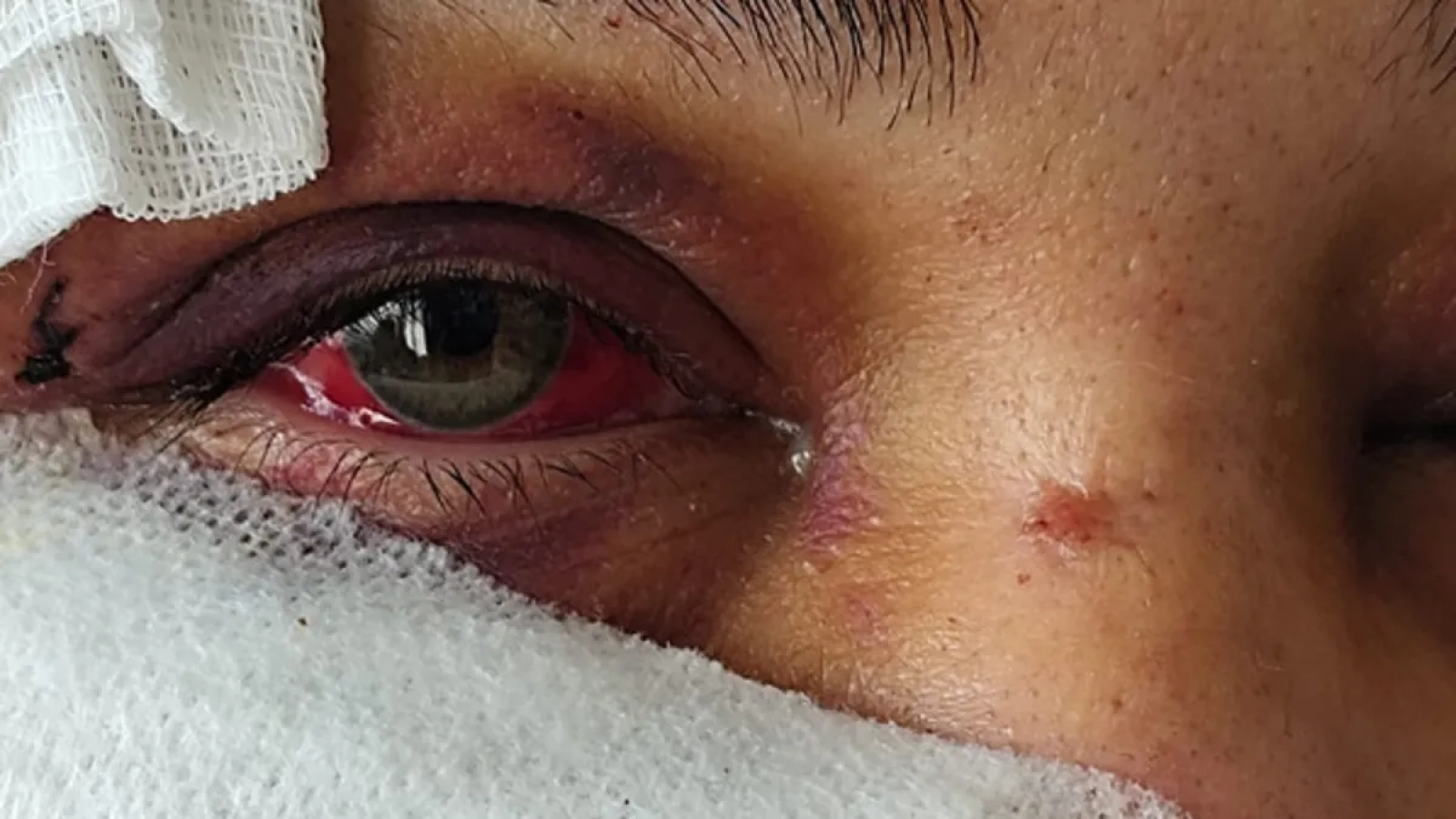 1200x675-kan-donduran-dehset-guzelligini-elinden-alacagim-dedi-yuzunu-parcaladi-tutuklandi-1768657524523